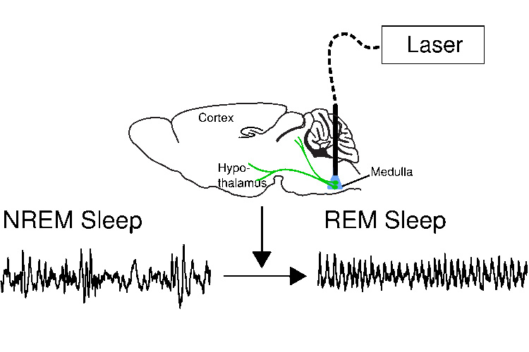 Dreams and Depression Exploring the Relationship between REM sleep and